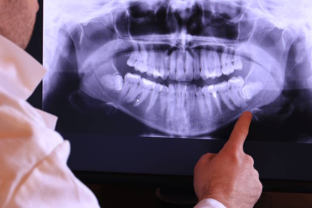 Best Emergency Cosmetic Dentistry (e.g., broken veneers) in Poulsbo, WA